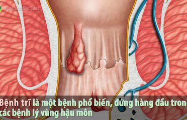 Phòng Khám Chuyên Trĩ Bác Sĩ Nguyễn Hữu Thợi